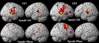 fmri