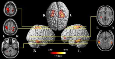 smri1